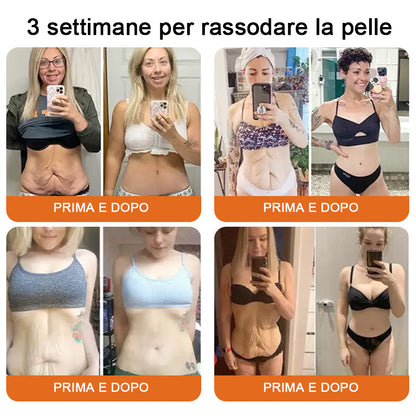Lotmay® crema completa al veleno d'api 🔥 ULTIMO GIORNO 80% di sconto 💎