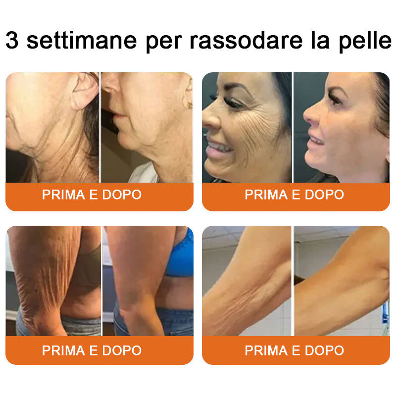 Lotmay® crema completa al veleno d'api 🔥 ULTIMO GIORNO 80% di sconto 💎