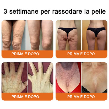 Lotmay® crema completa al veleno d'api 🔥 ULTIMO GIORNO 80% di sconto 💎