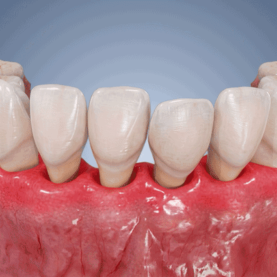 Purelora® GUMREVIVE GEL RIPARATORE PERIODONTALE 🏆