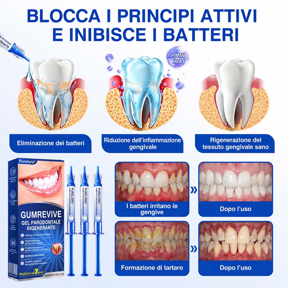 Purelora® GUMREVIVE GEL RIPARATORE PERIODONTALE 🏆