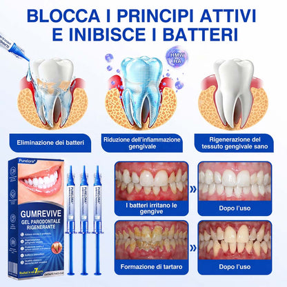 Purelora® GUMREVIVE GEL RIPARATORE PERIODONTALE 🏆