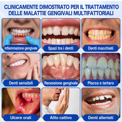 Purelora® GUMREVIVE GEL RIPARATORE PERIODONTALE 🏆