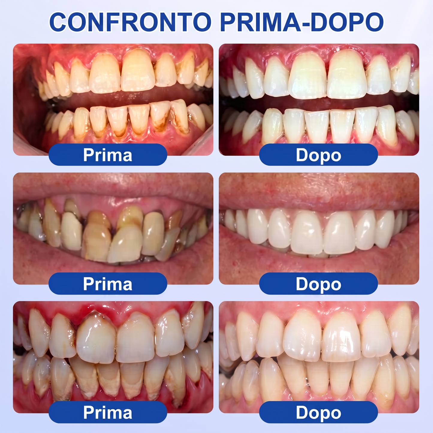 Purelora® GUMREVIVE GEL RIPARATORE PERIODONTALE 🏆