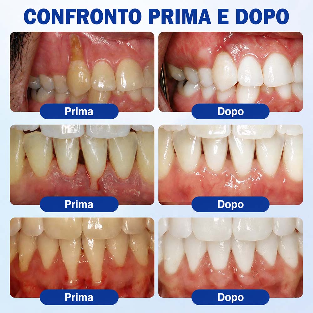 Purelora® GUMREVIVE GEL RIPARATORE PERIODONTALE 🏆