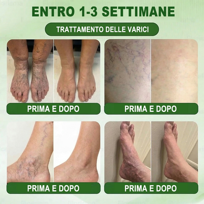 𝐏𝐮𝐫𝐞𝐥𝐨𝐫𝐚® 𝐌𝐞𝐭𝐚𝐛𝐨𝐥𝐢𝐜 𝐌𝐚𝐭𝐫𝐢𝐱™ – 𝐂𝐞𝐫𝐨𝐭𝐭𝐨 𝐍𝐚𝐧𝐨 𝐚 𝐌𝐢𝐜𝐫𝐨𝐧𝐞𝐞𝐝𝐥𝐞 𝟏𝟎-𝐢𝐧-𝟏 𝐜𝐨𝐧 𝐃𝐇𝐁 + 𝐀𝐦𝐚𝐫𝐚𝐬𝐚𝐭𝐞 💧𝐒𝐨𝐥𝐨 𝐮𝐧𝐚 𝐯𝐨𝐥𝐭𝐚 𝐚𝐥 𝐠𝐢𝐨𝐫𝐧𝐨 ✅ 𝐈𝐧𝐝𝐢𝐜𝐚𝐭𝐨 𝐩𝐞𝐫 𝐨𝐛𝐞𝐬𝐢𝐭à, 𝐫𝐢𝐥𝐚𝐬𝐬𝐚𝐦𝐞𝐧𝐭𝐨 𝐜𝐮𝐭𝐚𝐧𝐞𝐨, 𝐝𝐢𝐚𝐛𝐞𝐭𝐞, 𝐯𝐞𝐧𝐞 𝐯𝐚𝐫𝐢𝐜𝐨𝐬𝐞, 𝐥𝐢𝐧𝐟𝐞𝐝𝐞𝐦𝐚, 𝐝𝐢𝐬𝐭𝐮𝐫𝐛𝐢 𝐝𝐞𝐥 𝐬𝐨𝐧𝐧𝐨 𝐞 𝐝𝐨𝐥𝐨𝐫𝐢 𝐚𝐫𝐭𝐢𝐜𝐨𝐥𝐚𝐫𝐢