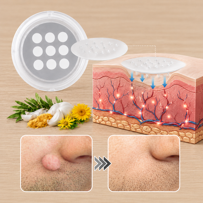 ✨Curalona® Cerotto 2 in 1 con Microneedle e Idrocolloide 🍀 | Aiuta a rimuovere nei in rilievo, acne, verruche piane e fibromi cutanei | Contribuisce a migliorare rughe, cicatrici e imperfezioni della pelle | Cerotti invisibili per viso e corpo