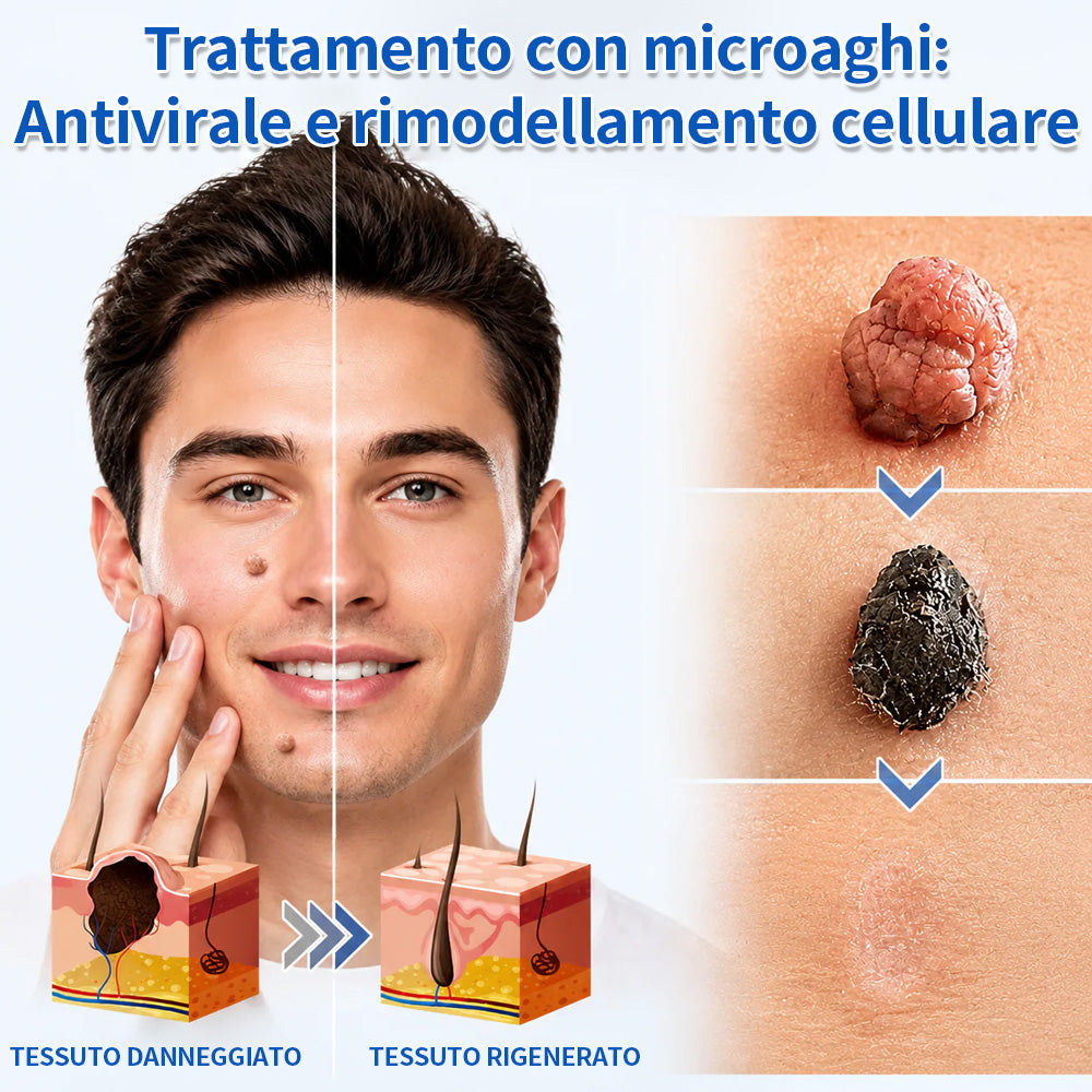✨Curalona® Cerotto 2 in 1 con Microneedle e Idrocolloide 🍀 | Aiuta a rimuovere nei in rilievo, acne, verruche piane e fibromi cutanei | Contribuisce a migliorare rughe, cicatrici e imperfezioni della pelle | Cerotti invisibili per viso e corpo