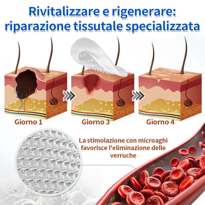 ✨Curalona® Cerotto 2 in 1 con Microneedle e Idrocolloide 🍀 | Aiuta a rimuovere nei in rilievo, acne, verruche piane e fibromi cutanei | Contribuisce a migliorare rughe, cicatrici e imperfezioni della pelle | Cerotti invisibili per viso e corpo