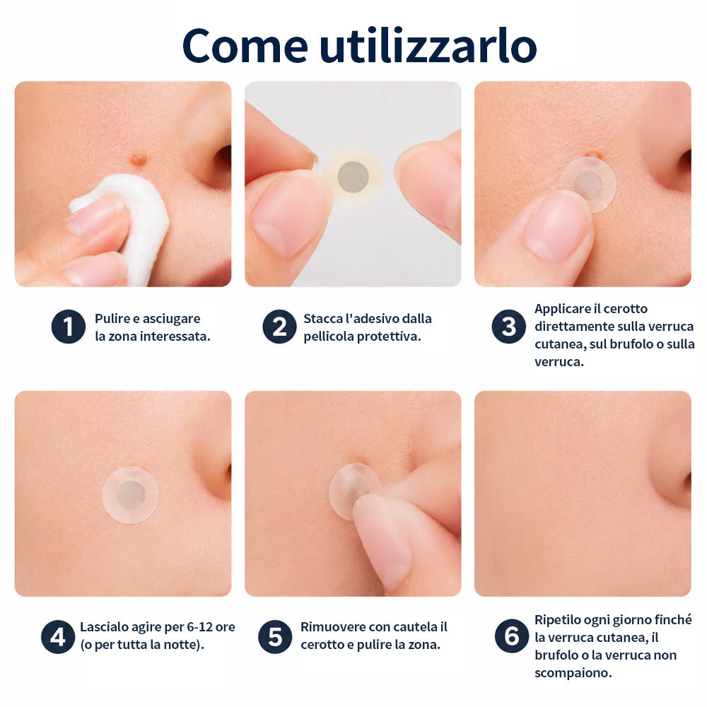 ✨Curalona® Cerotto 2 in 1 con Microneedle e Idrocolloide 🍀 | Aiuta a rimuovere nei in rilievo, acne, verruche piane e fibromi cutanei | Contribuisce a migliorare rughe, cicatrici e imperfezioni della pelle | Cerotti invisibili per viso e corpo